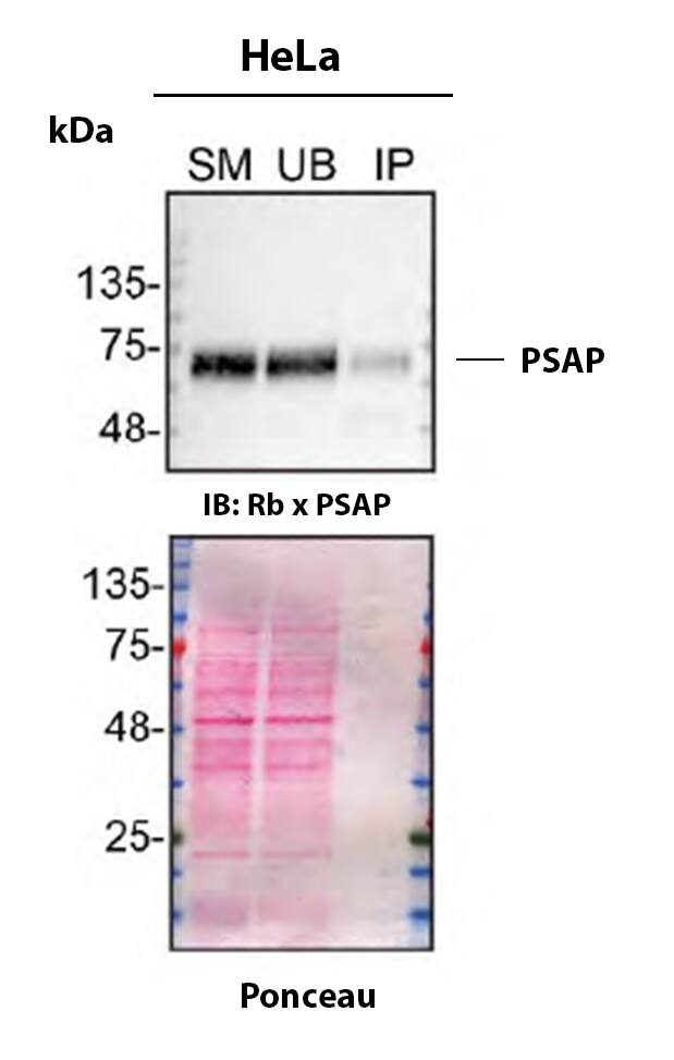 Detection of PSAP by Immunoprecipitation.