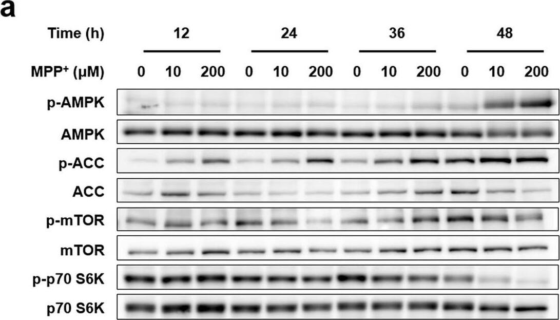 Detection of Human p70 S6 Kinase/S6K by Western Blot