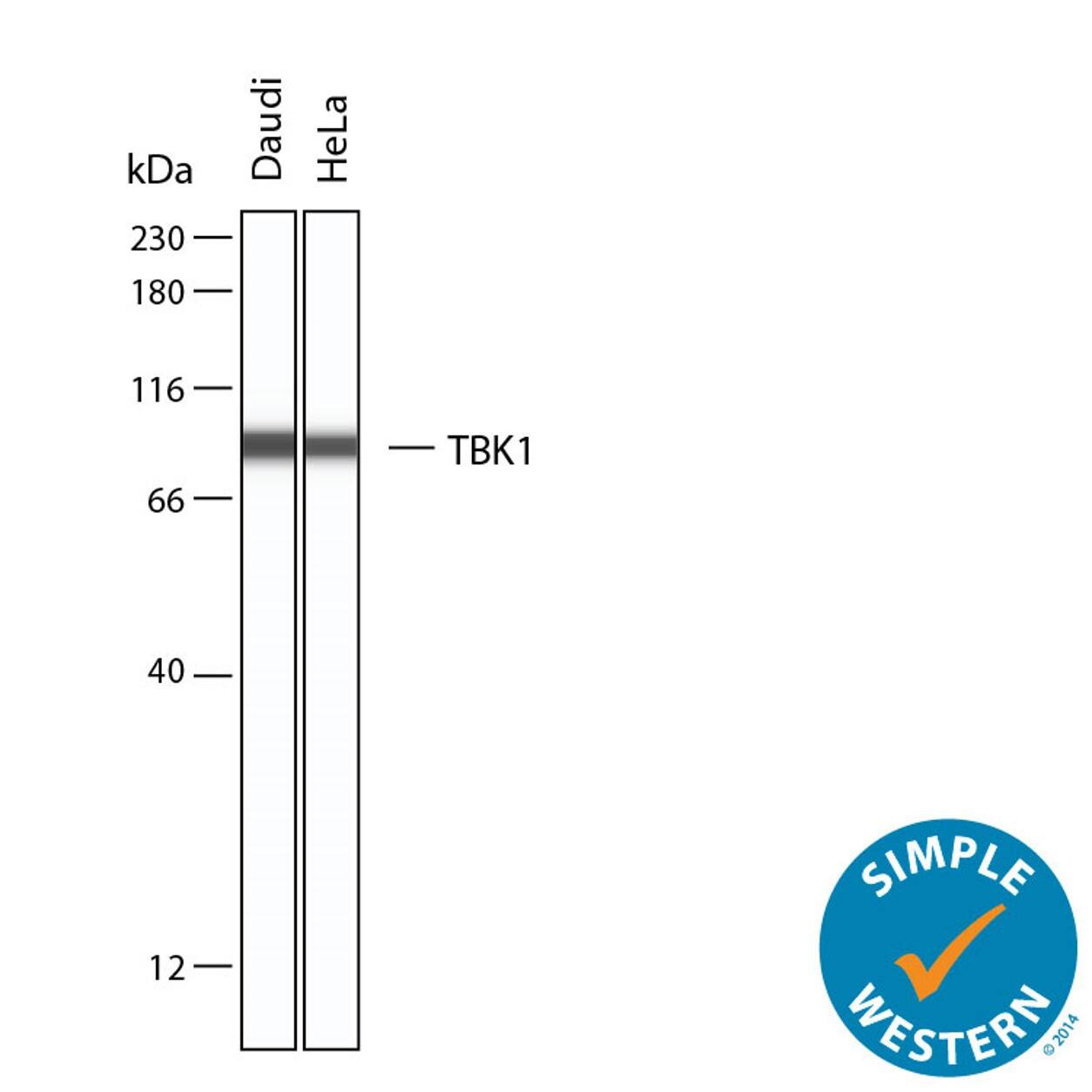 Detection of Human TBK1 by Simple Western<sup>TM</sup>.