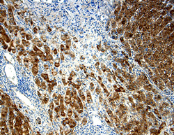 a-Fetoprotein/AFP antibody in Human Liver cancer