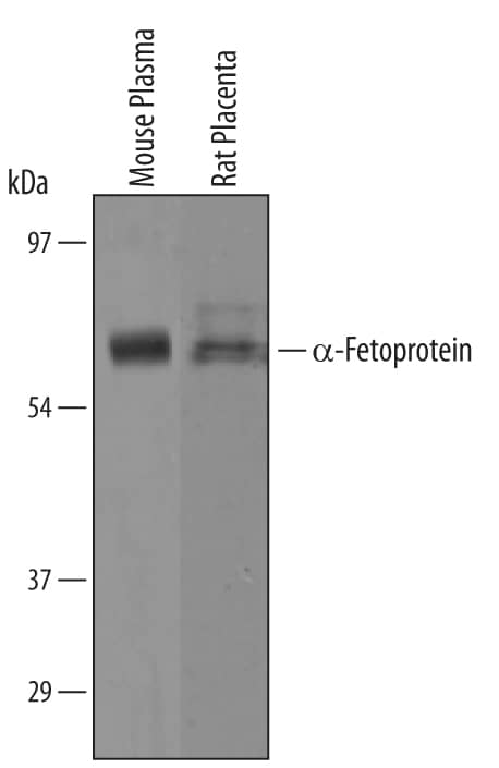 Detection of Mouse a-Fetoprotein/AFP antibody by Western Blot.