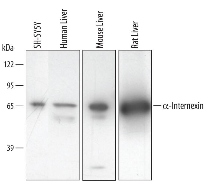 Detection of Human/Mouse/Rat a-Internexin antibody by Western Blot.