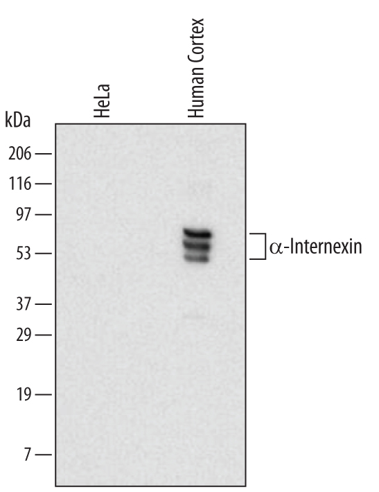 Detection of Human a-Internexin antibody by Western Blot.