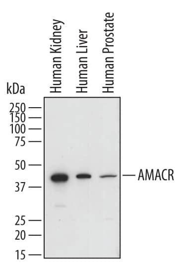 Detection of Human a-Methylacyl-CoA Racemase/AMACR antibody by Western Blot.