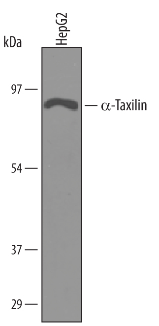 Detection of Human a-Taxilin antibody by Western Blot.