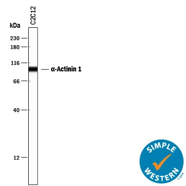 Detection of Mouse a-Actinin 1 antibody by Simple WesternTM.