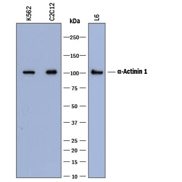 Detection of Human, Mouse, and Rat a-Actinin 1 antibody by Western Blot.