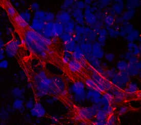 a-Cardiac Actin antibody in Human Cardiomyocytes by Immunocytochemistry (ICC).