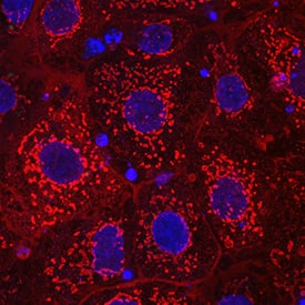 a-Fetoprotein/AFP antibody in BG01V Human Embryonic Stem Cells by Immunocytochemistry (ICC).