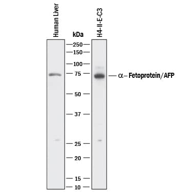 Detection of Human and Rat a-Fetoprotein/AFP antibody by Western Blot.