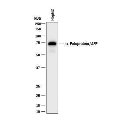 Detection of a-Fetoprotein/AFP antibody by Western Blot.