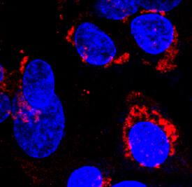 a-Fetoprotein/AFP antibody in BG01V Human Embryonic Stem Cells by Immunocytochemistry (ICC).