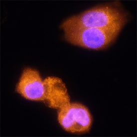 a-L-Iduronidase/IDUA antibody in HepG2 Human Cell Line by Immunocytochemistry (ICC).