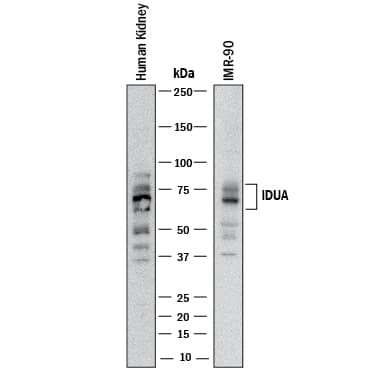 Detection of Human a-L-Iduronidase/IDUA antibody by Western Blot.