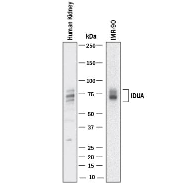 Detection of Human a-L-Iduronidase/IDUA antibody by Western Blot.