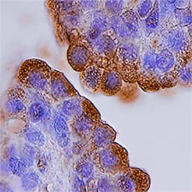 a-Methylacyl-CoA Racemase/AMACR antibody in Human Prostate Gland by Immunohistochemistry (IHC-P).