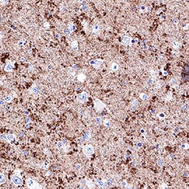 a-Synuclein antibody in Human Brain by Immunohistochemistry (IHC-P).