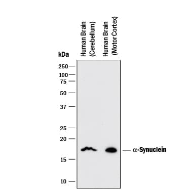 Detection of Human a-Synuclein antibody by Western Blot.