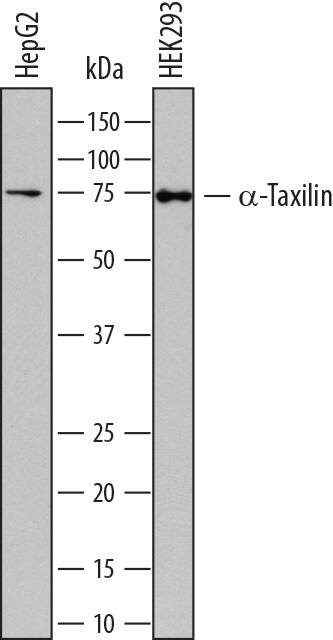 Detection of Human a-Taxilin antibody by Western Blot.