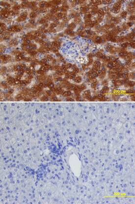 a1-Acid Glycoprotein antibody in Human Liver by Immunohistochemistry (IHC-P).