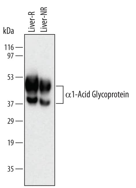 Detection of Human a1-Acid Glycoprotein antibody by Western Blot.