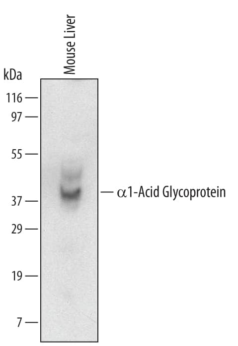 Detection of Mouse a1-Acid Glycoprotein antibody by Western Blot.