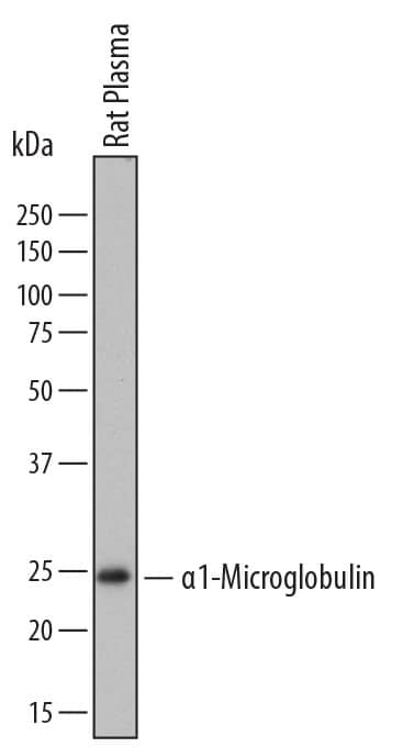 Detection of Rat a1-Microglobulin antibody by Western Blot.