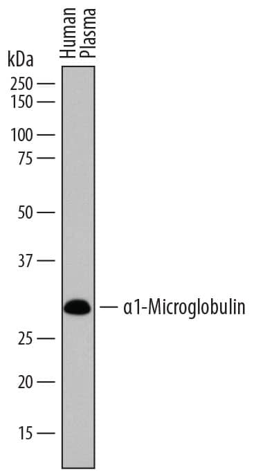 Detection of Human a1-Microglobulin antibody by Western Blot.