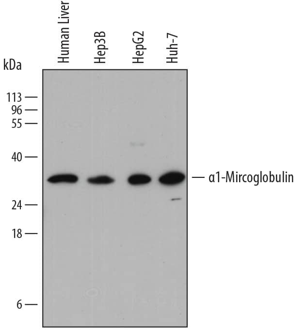 Detection of Human a1-Microglobulin antibody by Western Blot.