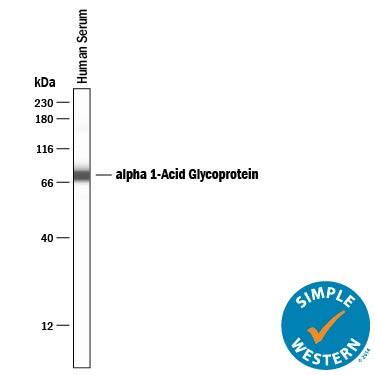 Detection of Human a1-Acid Glycoprotein antibody by Simple WesternTM.