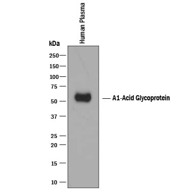 Detection of Human a1-Acid Glycoprotein antibody by Western Blot.