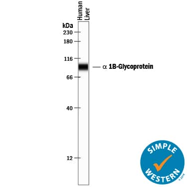 Detection of Human a 1B-Glycoprotein antibody by Simple WesternTM.