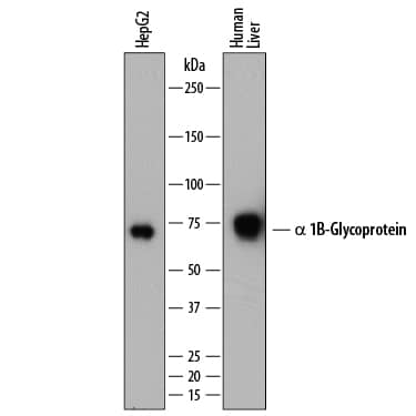 Detection of Human a 1B-Glycoprotein antibody by Western Blot.