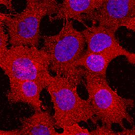 a 1B-Glycoprotein antibody in Hepa 1-6 Mouse Cell Line by Immunocytochemistry (ICC).