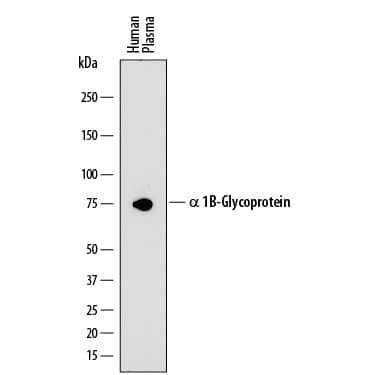 Detection of Human a 1B-Glycoprotein antibody by Western Blot.