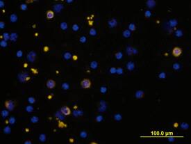 a2-Macroglobulin antibody in Human PBMCs by Immunocytochemistry (ICC).