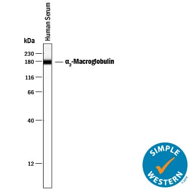 Detection of Human a2-Macroglobulin antibody by Simple WesternTM.