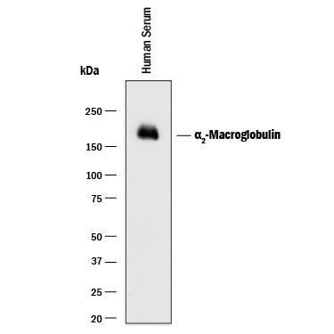 Detection of Human a2-Macroglobulin antibody by Western Blot.