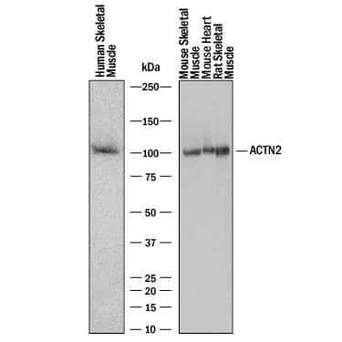 Detection of Human, Mouse, and Rat alpha Actinin 2 antibody by Western Blot.