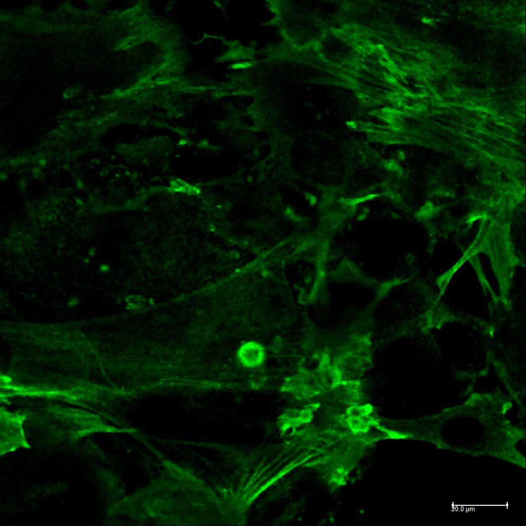 Detection of CD31/PECAM-1 in Human Lung Tissue.