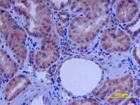 beta-Defensin 4/2 antibody in Human Kidney Array by Immunohistochemistry (IHC-P).