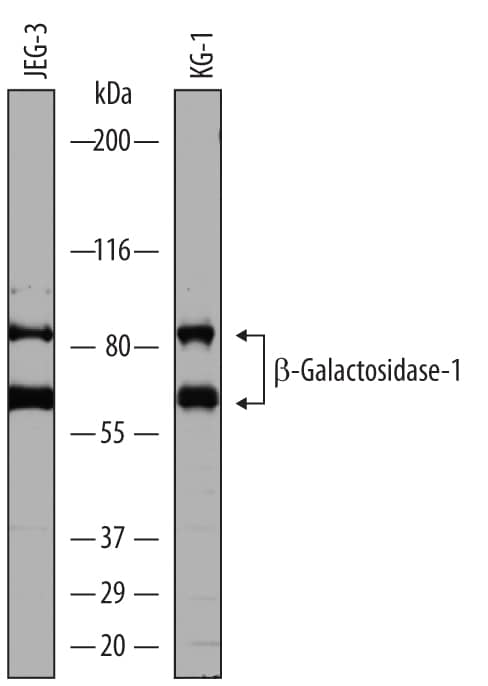 Detection of Human  beta-Galactosidase-1/GLB1 antibody by Western Blot.