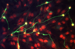 beta-III Tubulin antibody in Differentiated Human Neural Progenitor Cells by Immunocytochemistry (ICC).