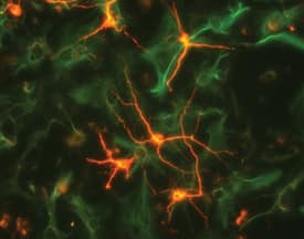 beta-III Tubulin antibody in Rat Cortical Neurons and GFAP antibody in Rat Astrocytes by Immunocytochemistry (ICC).