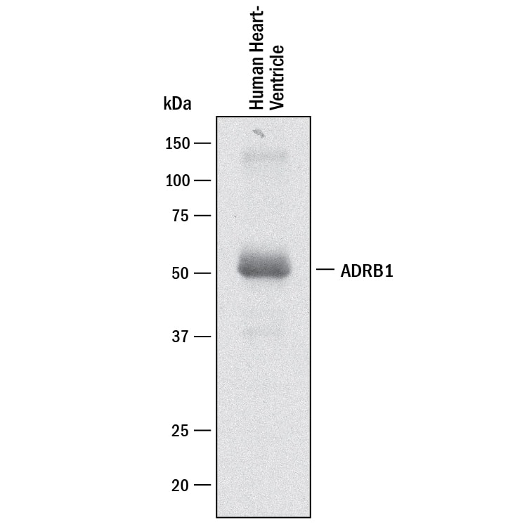 Detection of Human  beta-1 Adrenergic R/ADRB1 antibody by Western Blot.