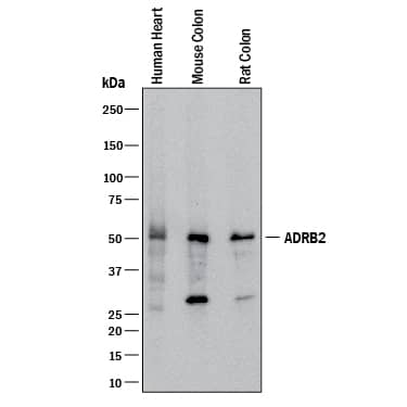 Detection of Human, Mouse, and Rat  beta-2 Adrenergic R/ADRB2 antibody by Western Blot.