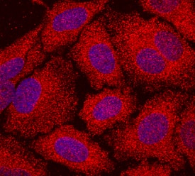 beta-Actin antibody in HeLa Human Cell Line by Immunocytochemistry (ICC).