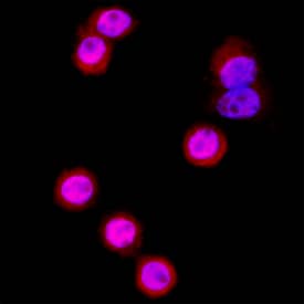 beta-Catenin antibody in SW480 Human Cell Line by Immunocytochemistry (ICC).