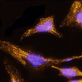 beta-III Spectrin antibody in HeLa Human Cell Line by Immunocytochemistry (ICC).