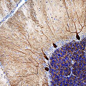 beta-III Spectrin antibody in Human Brain by Immunohistochemistry (IHC-P).